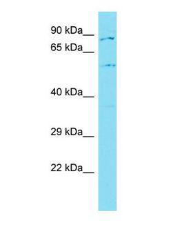 COLGALT2 / GLT25D2 Antibody - Western blot of GLT25D2 Antibody - C-terminal region with human MCF7 cells lysate.  This image was taken for the unconjugated form of this product. Other forms have not been tested.