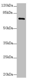 COLGALT2 / GLT25D2 Antibody - Western blot All lanes: COLGALT2 antibody at 0.5µg/ml + Mouse liver tissue Secondary Goat polyclonal to rabbit IgG at 1/10000 dilution Predicted band size: 73 kDa Observed band size: 73 kDa