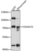 COLGALT2 / GLT25D2 Antibody - Western blot analysis of extracts of various cell lines, using COLGALT2 antibody at 1:1000 dilution. The secondary antibody used was an HRP Goat Anti-Rabbit IgG (H+L) at 1:10000 dilution. Lysates were loaded 25ug per lane and 3% nonfat dry milk in TBST was used for blocking. An ECL Kit was used for detection and the exposure time was 30s.