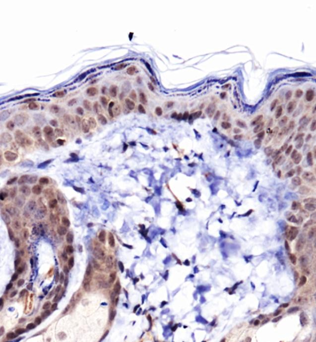 Collagen I Antibody - Immunohistochemistry: Collagen I Antibody - IHC of Collagen 1 in mouse epidermis using DAB with hematoxylin counterstain.