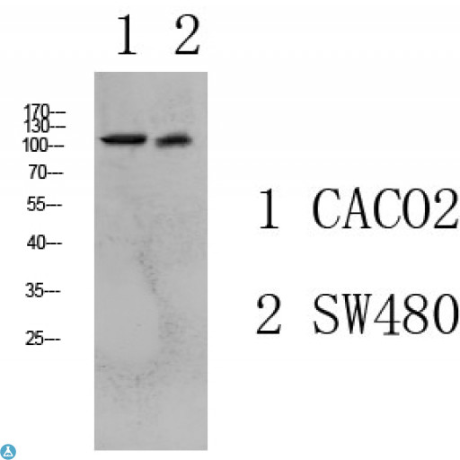 Collagen I Antibody - Western blot analysis of various lysate, antibody was diluted at 1000. Secondary antibody was diluted at 1:20000.