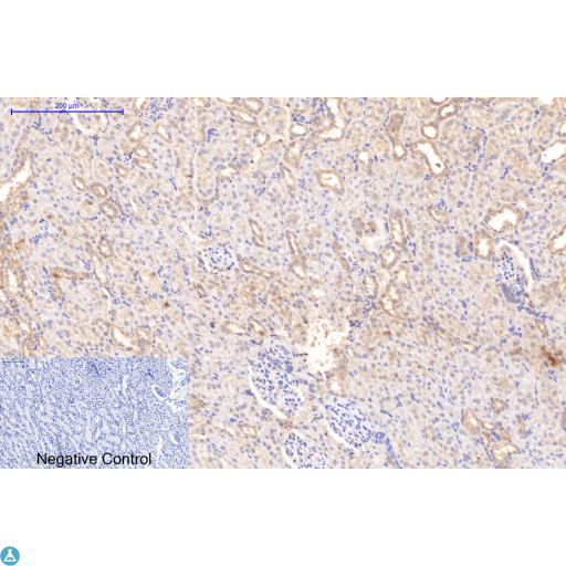 Collagen I Antibody - Immunohistochemical analysis of rat kidney tissue. Anti-Collagen I at 1:200 (4°C, overnight). Antigen retrieval - Sodium Citrate pH6 (>98°C, 20min). Secondary - 1:200 (room temp, 30min). Negative control - Secondary only