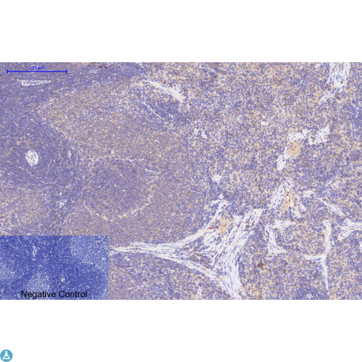 Collagen I Antibody - Immunohistochemical analysis of rat spleen tissue. Anti-Collagen I at 1:200 (4°C, overnight). Antigen retrieval - Sodium Citrate pH6 (>98°C, 20min). Secondary - 1:200 (room temp, 30min). Negative control - Secondary only