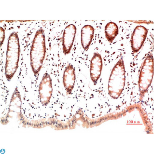 Collagen I Antibody - Immunohistochemical analysis of paraffin-embedded Human Skin Tissue using Collagen I Mouse monoclonal antibody diluted at 1:200.