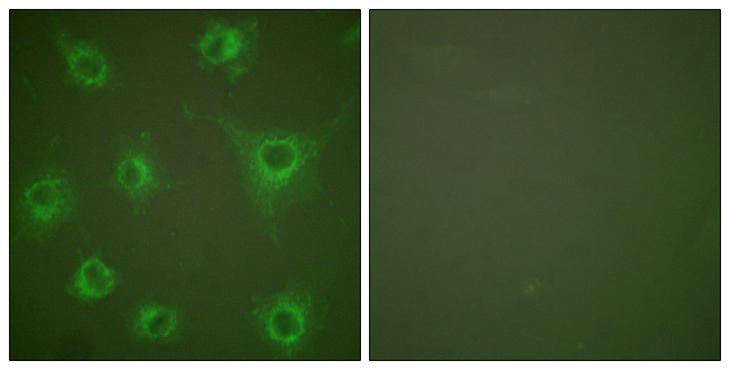 Collagen II Antibody - Peptide - + Immunofluorescence analysis of COS7 cells, using Collagen II antibody.