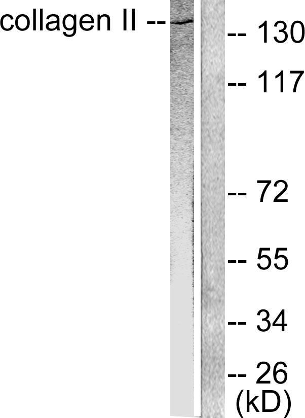 Collagen II Antibody - Western blot analysis of extracts from COLO205 cells, using Collagen II antibody.