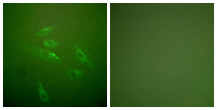 Collagen III Antibody - Immunofluorescence analysis of HeLa cells, using Collagen III Antibody. The picture on the right is blocked with the synthesized peptide.