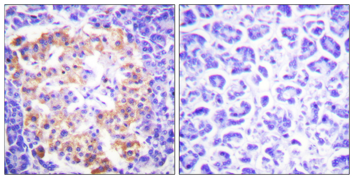 Collagen III Antibody - Immunohistochemistry analysis of paraffin-embedded human pancreas tissue, using Collagen III Antibody. The picture on the right is blocked with the synthesized peptide.