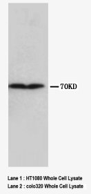 Collagen III Antibody -  This image was taken for the unconjugated form of this product. Other forms have not been tested.