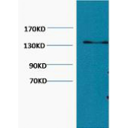 Collagen III Antibody - Western blot of Collagen III antibody