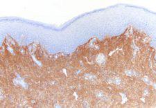 Collagen III Antibody - Collagen Type III on human skin paraffin section DAB, hematoxylin
