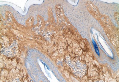 Collagen III Antibody - Collagen Type III on bovine skin paraffin section DAB, hematoxylin