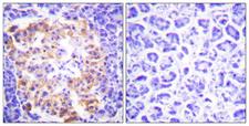 Collagen III Antibody - Peptide - + Immunohistochemistry analysis of paraffin-embedded human pancreas tissue, using Collagen III antibody.