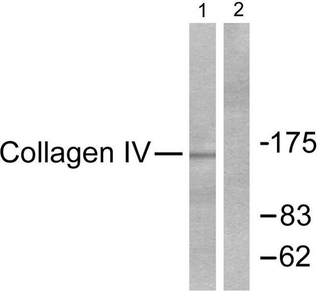 Collagen IV Antibody - Western blot analysis of lysates from HeLa cells, using Collagen IV Antibody. The lane on the right is blocked with the synthesized peptide.