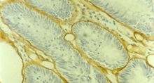 Collagen IV Antibody - Immunohistochemistry on paraffin section of human colon