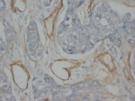 Collagen IV Antibody -  This image was taken for the unconjugated form of this product. Other forms have not been tested.
