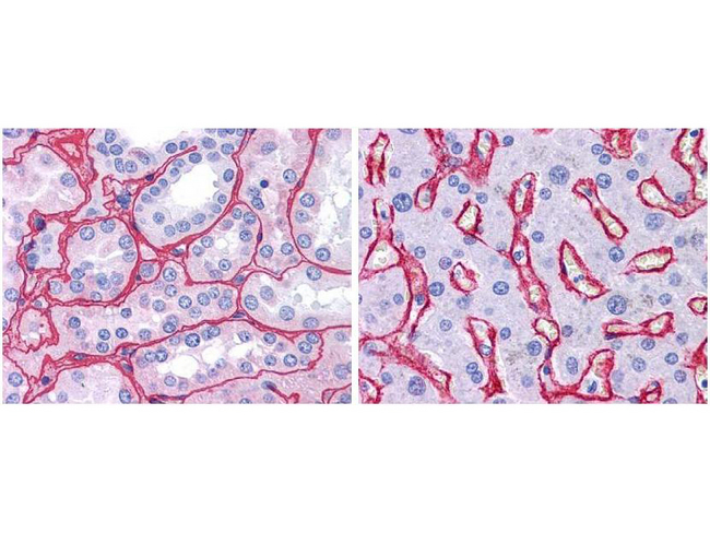 Collagen IV Antibody - Immunohistochemistry of rabbit Anti-Collagen IV Biotin Conjugated Antibody. Tissue: human kidney (Left) with strong red staining observed in glomeruli and liver (Right) with strong staining in sinusoids. Fixation: formalin fixed paraffin embedded. Antigen retrieval: steamed in 0.01 M sodium citrate buffer, pH 6.0 at 99-100°C - 20 minutes. Primary antibody: Collagen IV antibody at 10 µg/mL for 1 h at RT. Secondary antibody: Peroxidase rabbit secondary antibody at 1:10,000 for 45 min at RT. Localization: Collagen IV is extracellular. Staining: Collagen IV as precipitated red signal with hematoxylin purple nuclear counterstain.