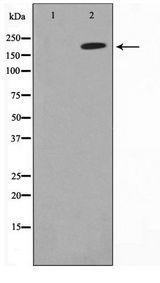 Collagen IV Antibody - Western blot of HeLa cell lysate using Collagen IV Antibody