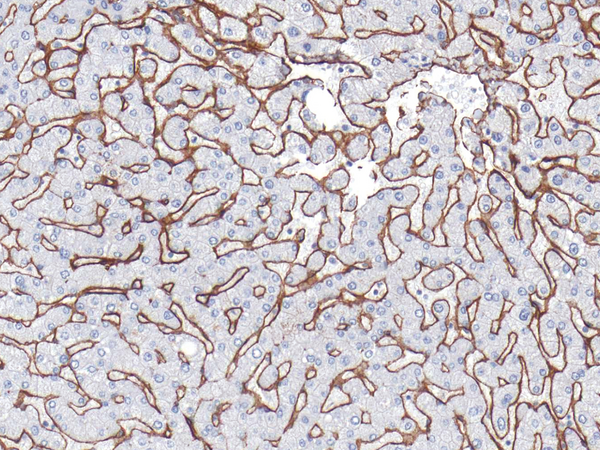 Collagen IV Antibody