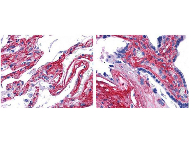 Collagen V Antibody - Anti collagen V antibody showed strong staining in FFPE sections of human lung (left) with strong staining within alveoli, vessels, and in connective tissue spaces; and placenta (right) with strong staining observed in stromal and connective tissue spaces and vessel walls. Slides were steamed in 0.01 M sodium citrate buffer, pH 6.0 at 99-100°C - 20 minutes for antigen retrieval.