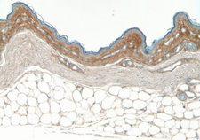 Collagen V Antibody - Collagen Type V on chicken skin paraffin section DAB, hematoxylin