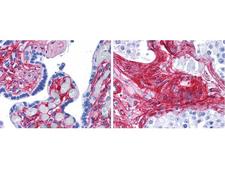 Collagen VI Antibody - Immunohistochemistry of rabbit anti-collagen VI antibody. Tissue: human placenta (left), testis (right). Fixation: formalin fixed paraffin embedded. Antigen retrieval: steamed in 0.01 M sodium citrate buffer, pH 6.0 at 99-100°C - 20 minutes. Primary antibody: collagen VI antibody at 10 µg/mL for 1 h at RT. Secondary antibody: Peroxidase rabbit secondary antibody at 1:10,000 for 45 min at RT. Localization: collagen VI is extracellular. Staining: collagen VI as precipitated red signal red staining of stromal and extracellular spaces in the placenta and extracellular spaces between seminiferous tubules in the testis, with hematoxylin purple nuclear counterstain.