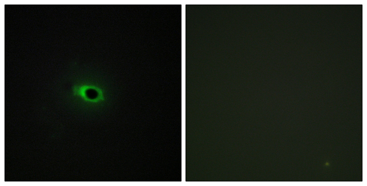 Collagen XII Alpha 1 Antibody - Immunofluorescence analysis of COS7 cells, using Collagen XII alpha1 Antibody. The picture on the right is blocked with the synthesized peptide.