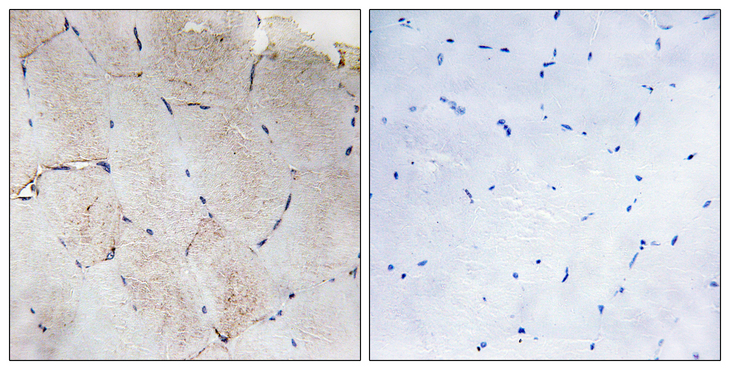 Collagen XII Alpha 1 Antibody - Immunohistochemistry analysis of paraffin-embedded human skeletal muscle tissue, using Collagen XII alpha1 Antibody. The picture on the right is blocked with the synthesized peptide.