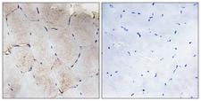 Collagen XII Alpha 1 Antibody - Immunohistochemistry analysis of paraffin-embedded human skeletal muscle tissue, using Collagen XII alpha1 Antibody. The picture on the right is blocked with the synthesized peptide.