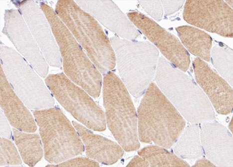 Collagen XII Alpha 1 Antibody - 1:100 staining human skeletal muscle tissue by IHC-P. The tissue was formaldehyde fixed and a heat mediated antigen retrieval step in citrate buffer was performed. The tissue was then blocked and incubated with the antibody for 1.5 hours at 22°C. An HRP conjugated goat anti-rabbit antibody was used as the secondary.
