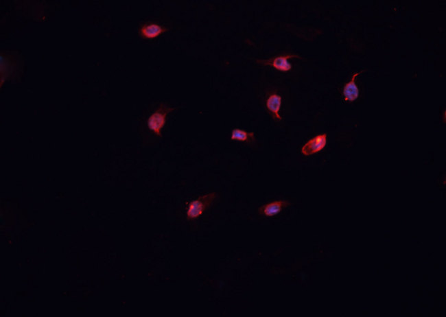 Collagen XII Alpha 1 Antibody - Staining U-2 OS cells by IF/ICC. The samples were fixed with PFA and permeabilized in 0.1% Triton X-100, then blocked in 10% serum for 45 min at 25°C. The primary antibody was diluted at 1:200 and incubated with the sample for 1 hour at 37°C. An Alexa Fluor 594 conjugated goat anti-rabbit IgG (H+L) antibody, diluted at 1/600, was used as secondary antibody.