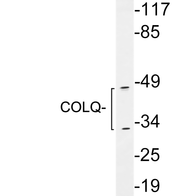 COLQ Antibody - Western blot analysis of lysates from Jurkat cells , using COLQ antibody.