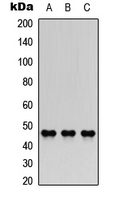 COLQ Antibody - Western blot analysis of AChE Q expression in A549 (A); NS-1 (B); H9C2 (C) whole cell lysates.