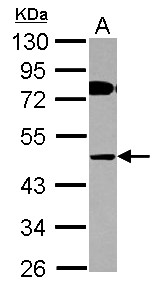 COLQ Antibody - Sample (30 ug of whole cell lysate) A: HepG2 10% SDS PAGE COLQ antibody diluted at 1:1000