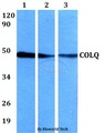COLQ Antibody - Western blot of COLQ antibody at 1:500 dilution. Lane 1: A549 whole cell lysate. Lane 2: sp2/0 whole cell lysate. Lane 3: H9C2 whole cell lysate.