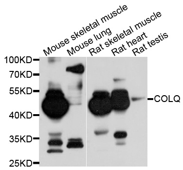 COLQ Antibody - Western blot analysis of extracts of various cell lines, using COLQ antibody at 1:1000 dilution. The secondary antibody used was an HRP Goat Anti-Rabbit IgG (H+L) at 1:10000 dilution. Lysates were loaded 25ug per lane and 3% nonfat dry milk in TBST was used for blocking. An ECL Kit was used for detection and the exposure time was 15s.