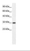 COLQ Antibody - Jurkat Cell Lysate.  This image was taken for the unconjugated form of this product. Other forms have not been tested.