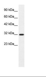 COLQ Antibody - Jurkat Cell Lysate.  This image was taken for the unconjugated form of this product. Other forms have not been tested.