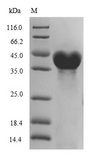 DNA Ligase Protein - (Tris-Glycine gel) Discontinuous SDS-PAGE (reduced) with 5% enrichment gel and 15% separation gel.