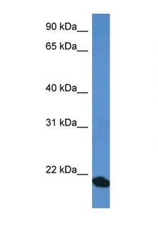 COMMD1 Antibody - COMMD1 antibody Western blot of Fetal Heart lysate. Antibody concentration 1 ug/ml.  This image was taken for the unconjugated form of this product. Other forms have not been tested.