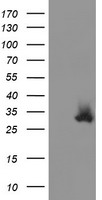 COMMD1 Antibody - HEK293T cells were transfected with the pCMV6-ENTRY control (Left lane) or pCMV6-ENTRY COMMD1 (Right lane) cDNA for 48 hrs and lysed. Equivalent amounts of cell lysates (5 ug per lane) were separated by SDS-PAGE and immunoblotted with anti-COMMD1.