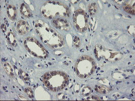 COMMD1 Antibody - IHC of paraffin-embedded Human Kidney tissue using anti-COMMD1 mouse monoclonal antibody. (Heat-induced epitope retrieval by 10mM citric buffer, pH6.0, 100C for 10min).