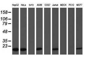 COMMD1 Antibody - Western blot of extracts (35ug) from 9 different cell lines by using anti-COMMD1 monoclonal antibody (HepG2: human; HeLa: human; SVT2: mouse; A549: human; COS7: monkey; Jurkat: human; MDCK: canine; PC12: rat; MCF7: human).