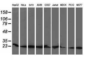 COMMD1 Antibody - Western blot of extracts (35ug) from 9 different cell lines by using anti-COMMD1 monoclonal antibody (HepG2: human; HeLa: human; SVT2: mouse; A549: human; COS7: monkey; Jurkat: human; MDCK: canine; PC12: rat; MCF7: human).