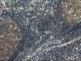 COMMD1 Antibody - IHC of paraffin-embedded Human tonsil using anti-COMMD1 mouse monoclonal antibody.