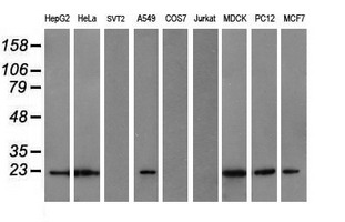 COMMD1 Antibody - Western blot of extracts (35ug) from 9 different cell lines by using anti-COMMD1 monoclonal antibody (HepG2: human; HeLa: human; SVT2: mouse; A549: human; COS7: monkey; Jurkat: human; MDCK: canine; PC12: rat; MCF7: human).