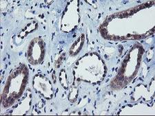 COMMD1 Antibody - IHC of paraffin-embedded Human Kidney tissue using anti-COMMD1 mouse monoclonal antibody. (Heat-induced epitope retrieval by 10mM citric buffer, pH6.0, 100C for 10min).