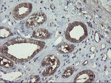 COMMD1 Antibody - IHC of paraffin-embedded Human Kidney tissue using anti-COMMD1 mouse monoclonal antibody.
