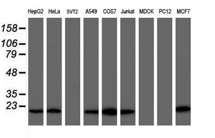 COMMD1 Antibody - Western blot of extracts (35 ug) from 9 different cell lines by using g anti-COMMD1 monoclonal antibody (HepG2: human; HeLa: human; SVT2: mouse; A549: human; COS7: monkey; Jurkat: human; MDCK: canine; PC12: rat; MCF7: human).