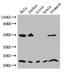 COMMD1 Antibody - Positive WB detected in:Hela whole cell lysate,Jurkat whole cell lysate,Mouse liver tissue,Mouse brain tissue,Mouse stomach tissue;All lanes: COMMD1 antibody at 3.4ug/ml;Secondary;Goat polyclonal to rabbit IgG at 1/50000 dilution;Predicted band size: 22,18 kDa;Observed band size: 22,50 kDa;